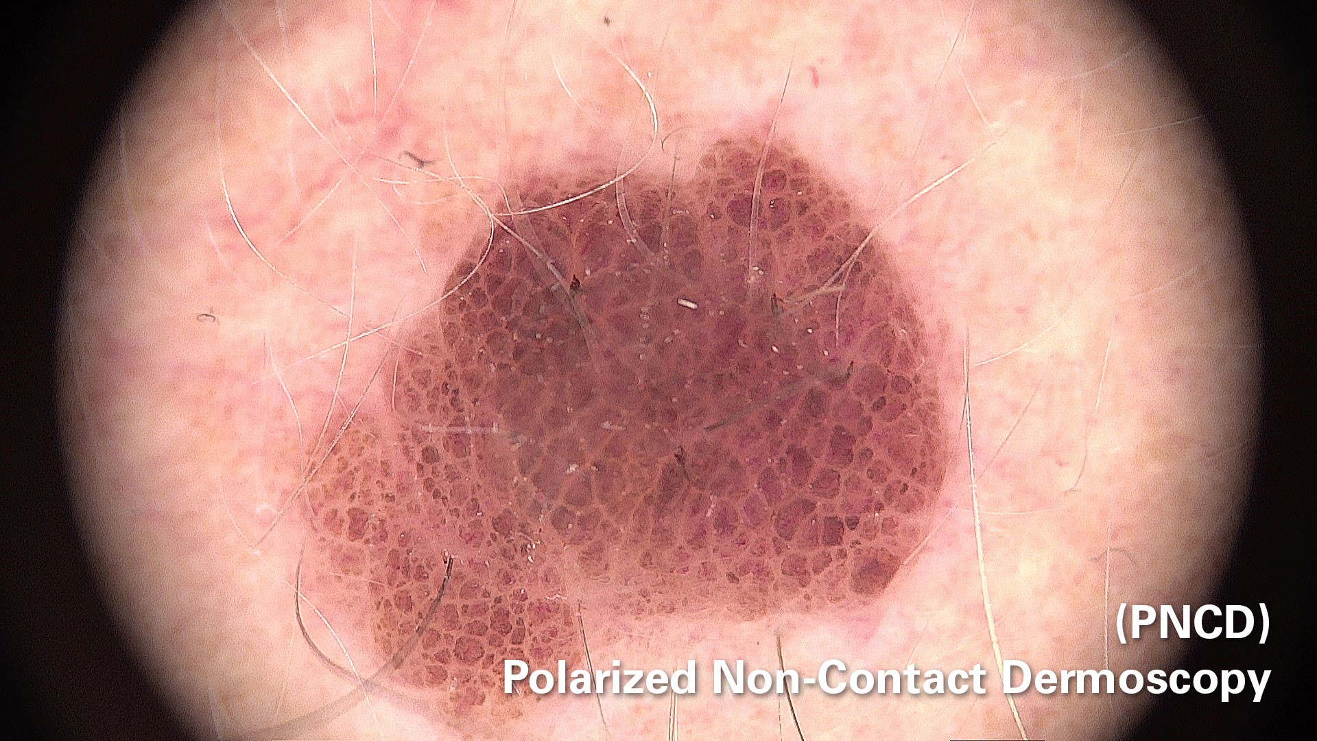 Polarization without skin contact