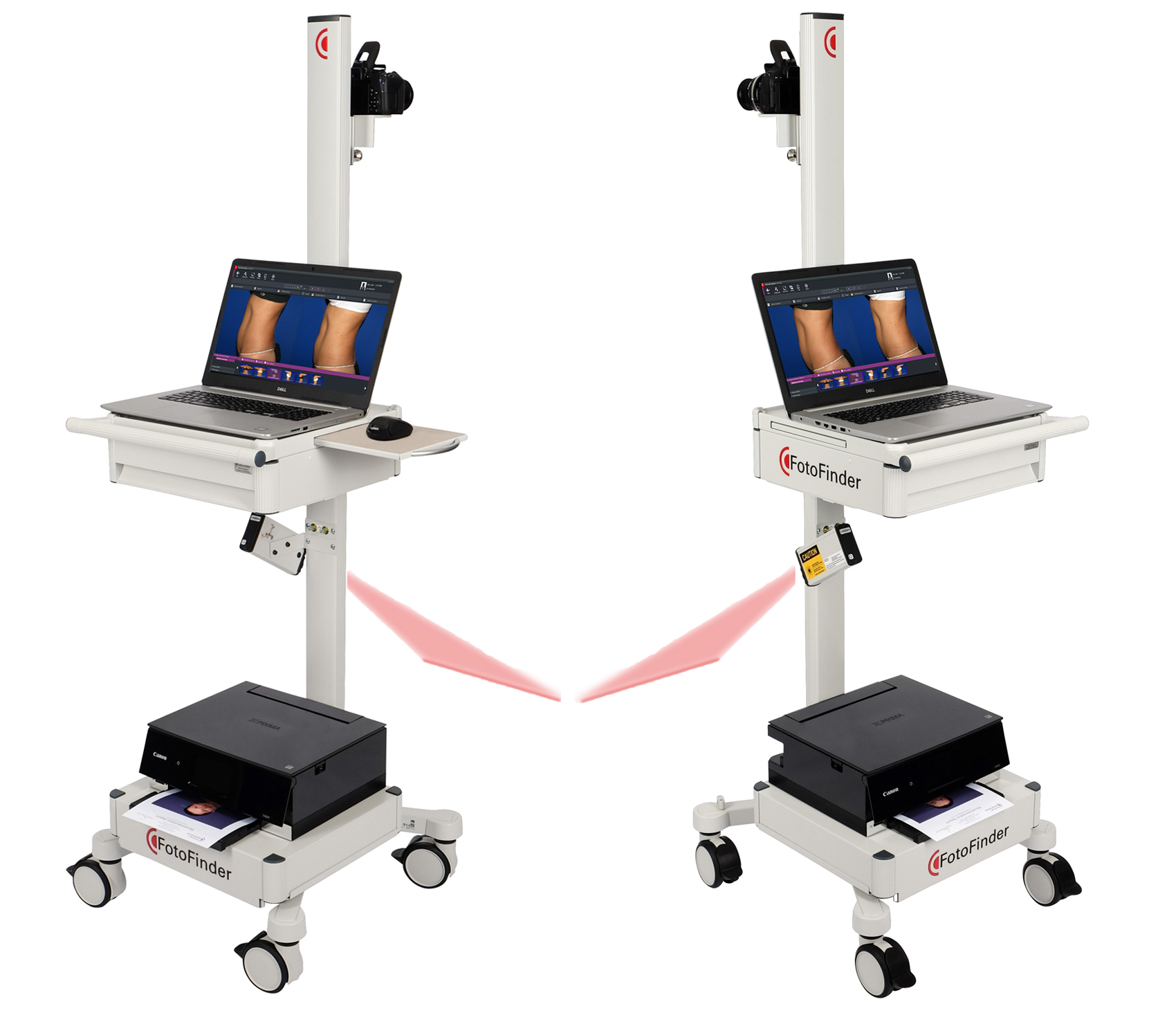 Bodystation left and right side view Bodystation left and right side with laser liner turned on